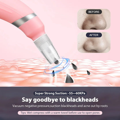 Portable Diamond Microdermabrasion Peeling Machine Silicone Hydrodermabrasion Facial Vacuum Blackhead Removal Skin Pore Cleaning